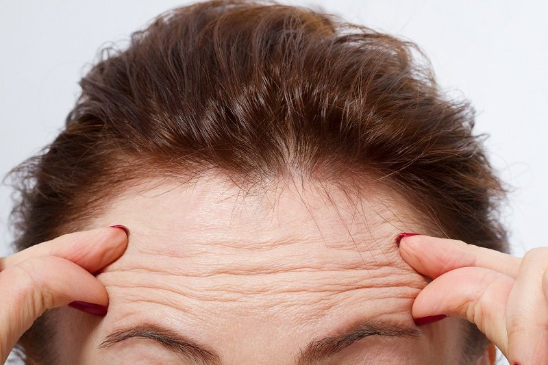 botox for horizontal forehead lines