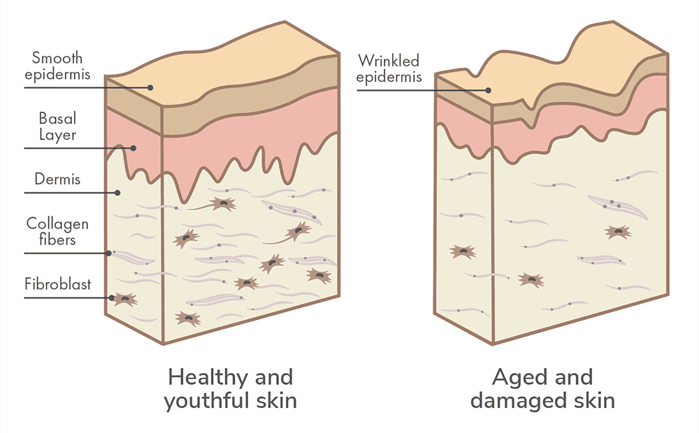 What Is Skin Rejuvenation and How Does It Work?