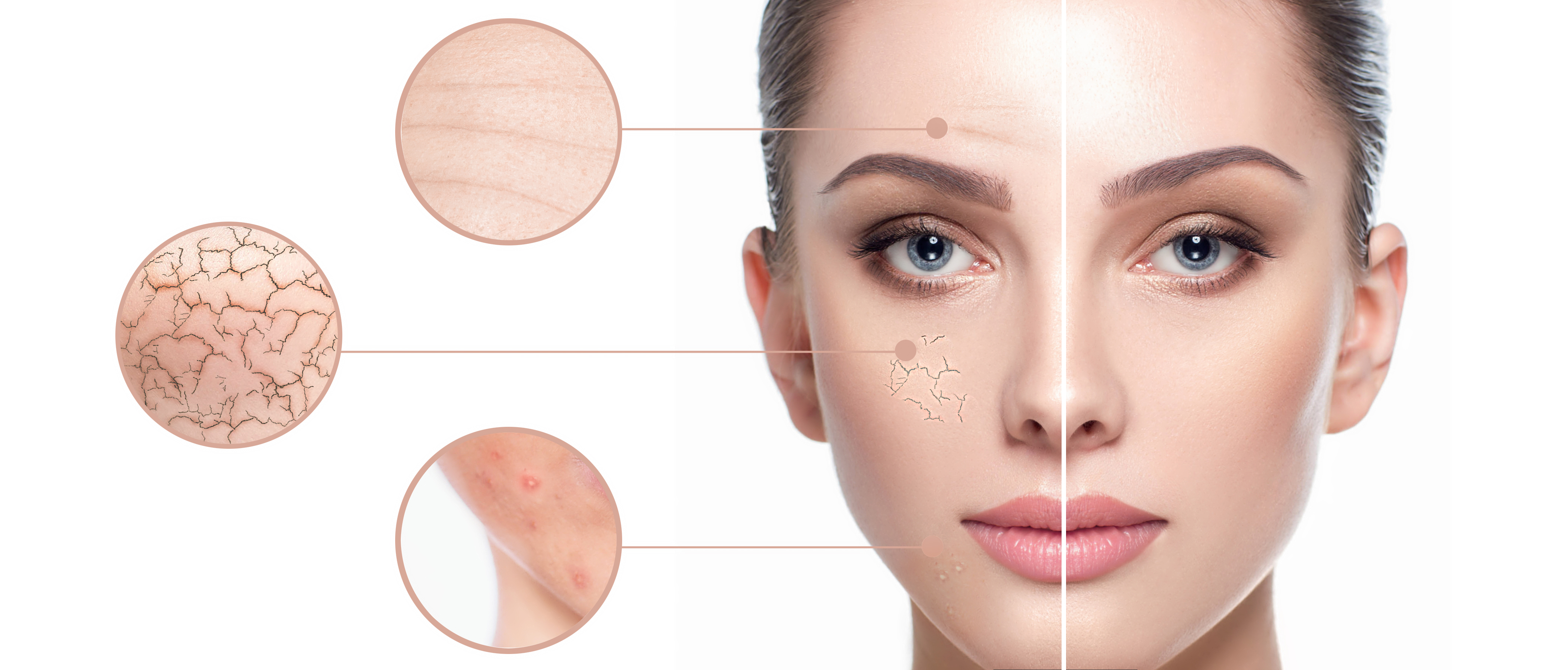 skin rejuvenation treatment