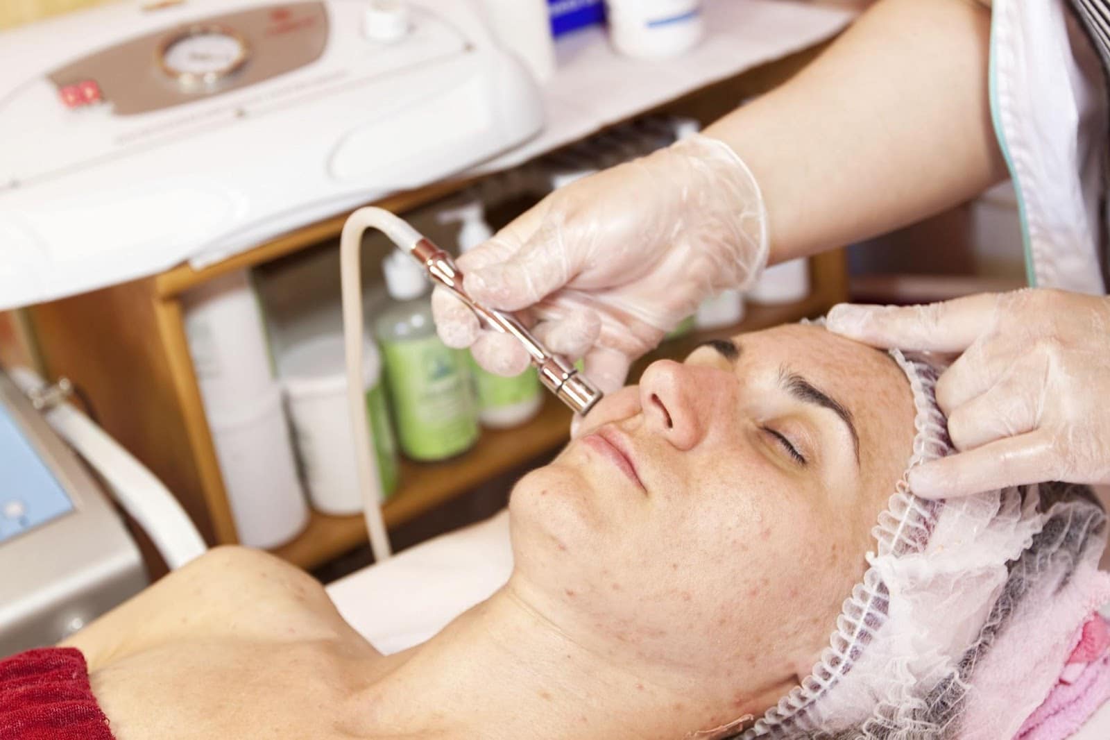 Dermabrasion
