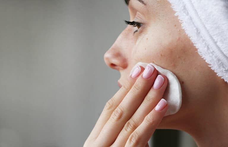 Common Causes of Adult Acne and How to Treat It