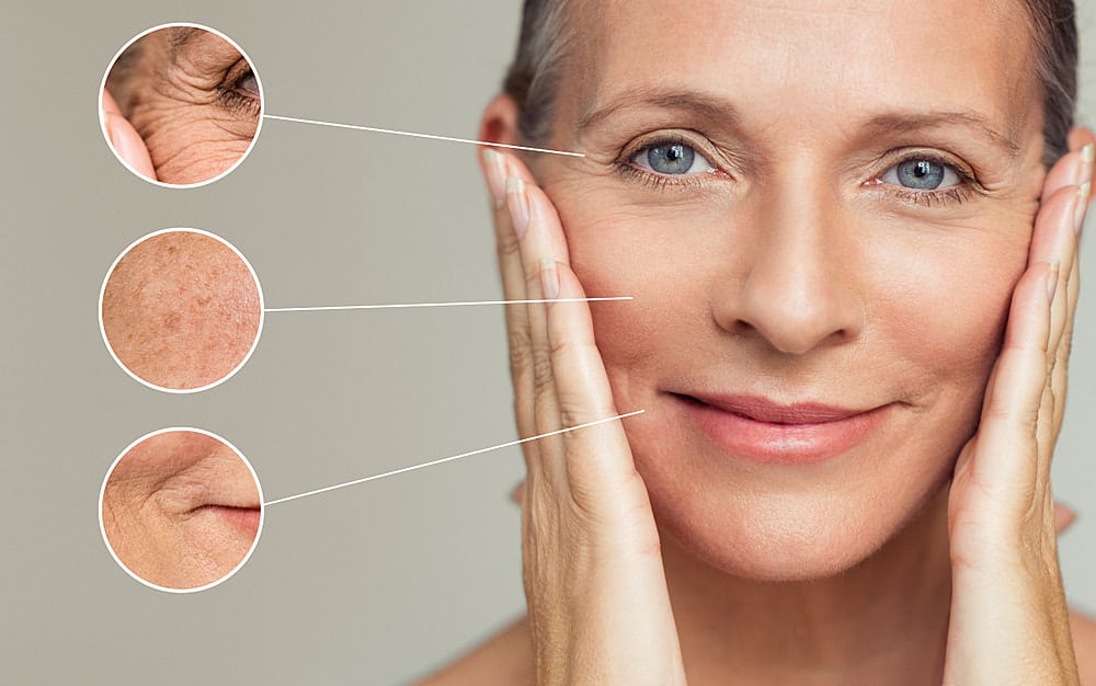 Profhilo treatment in Singapore