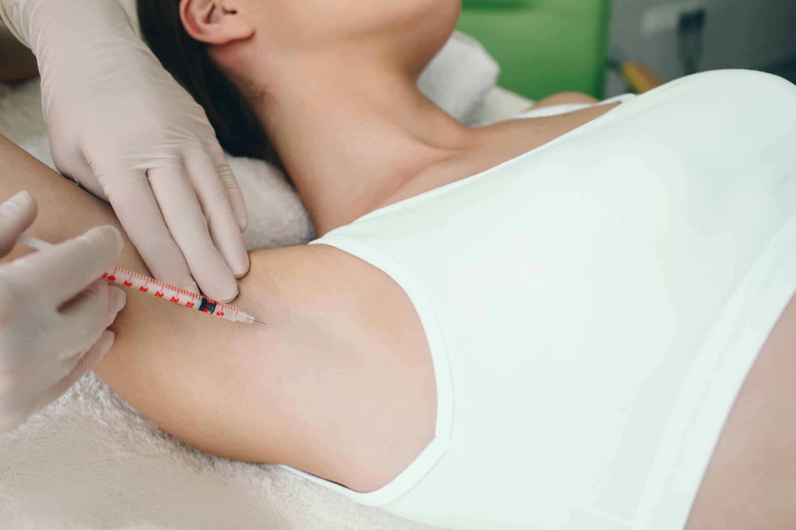 botox for sweating