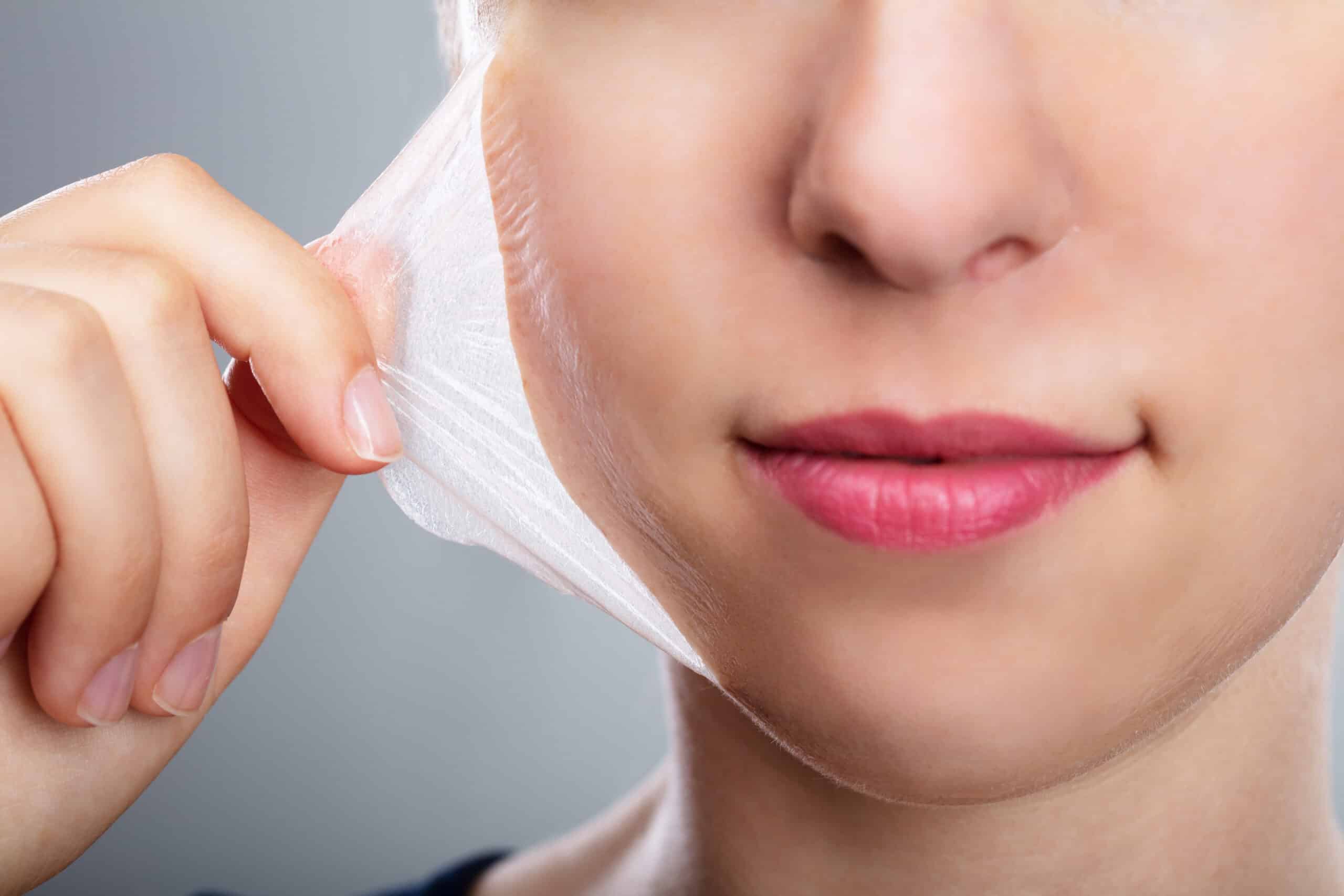Are Chemical Peels and Lasers Obsolete