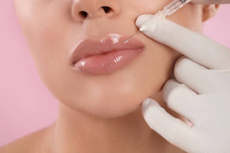 Lip Fillers Singapore