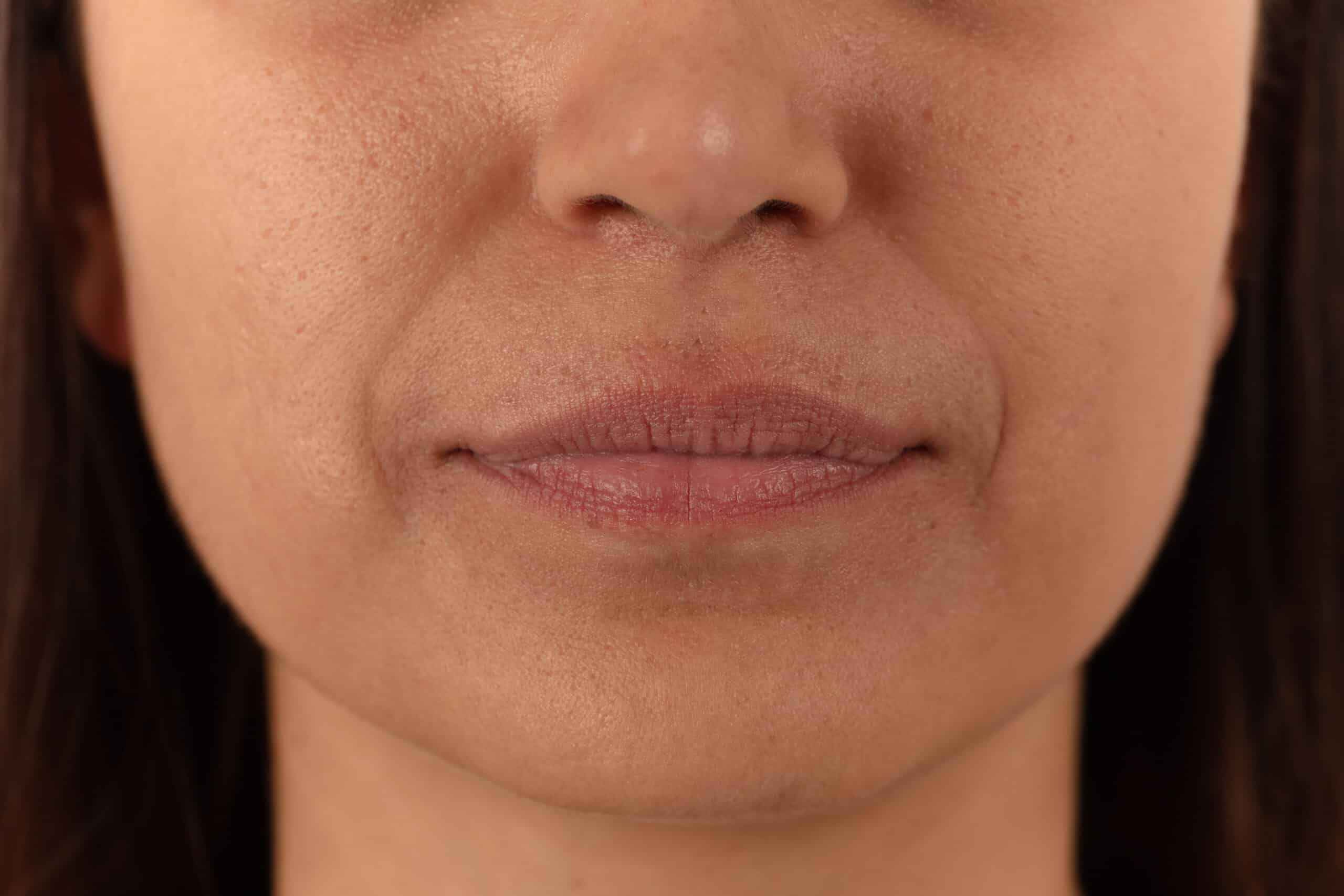 Thin Lips