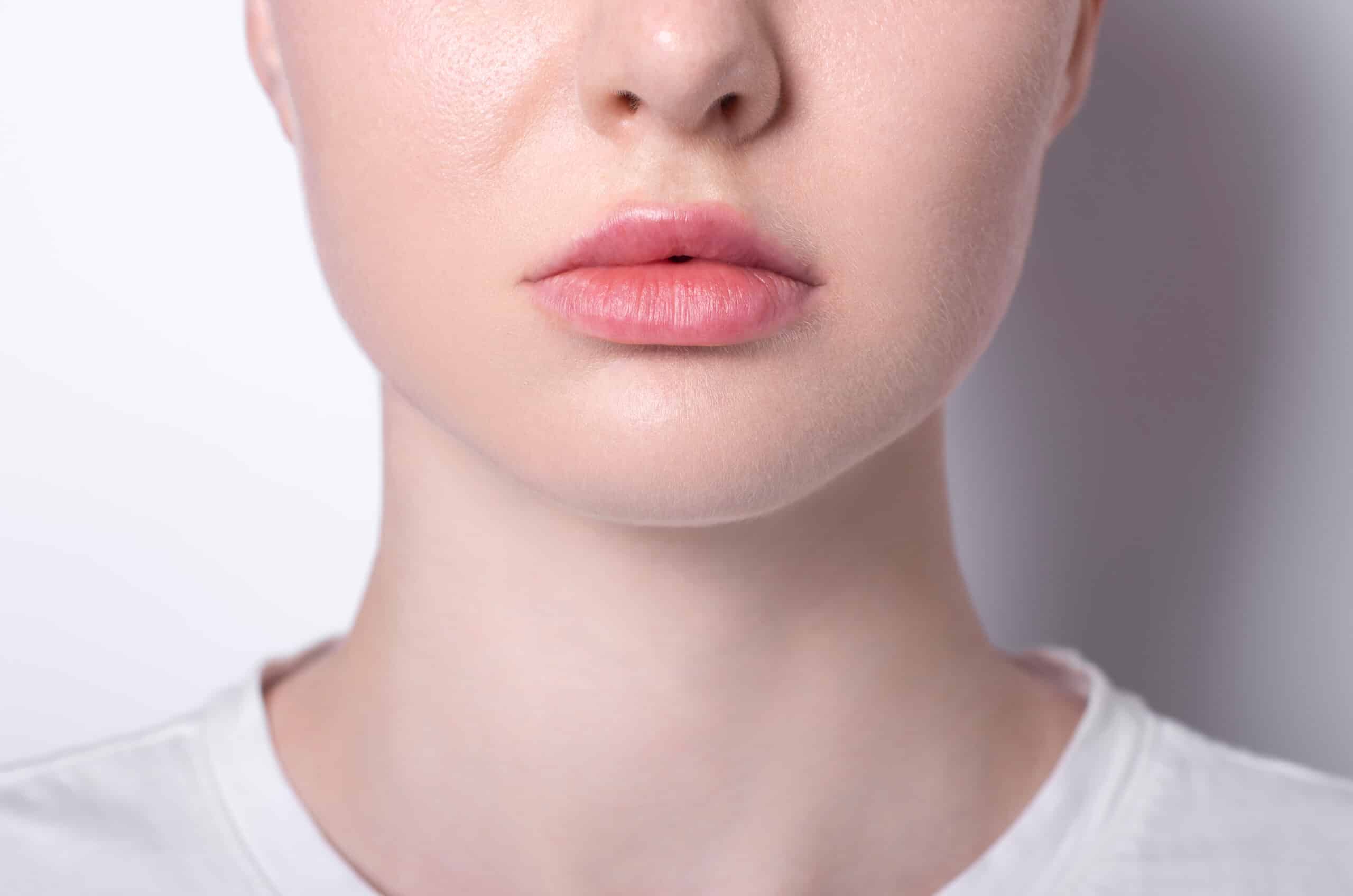 Uneven Lips