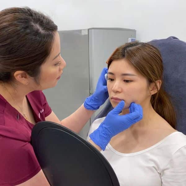 Botox Consultation