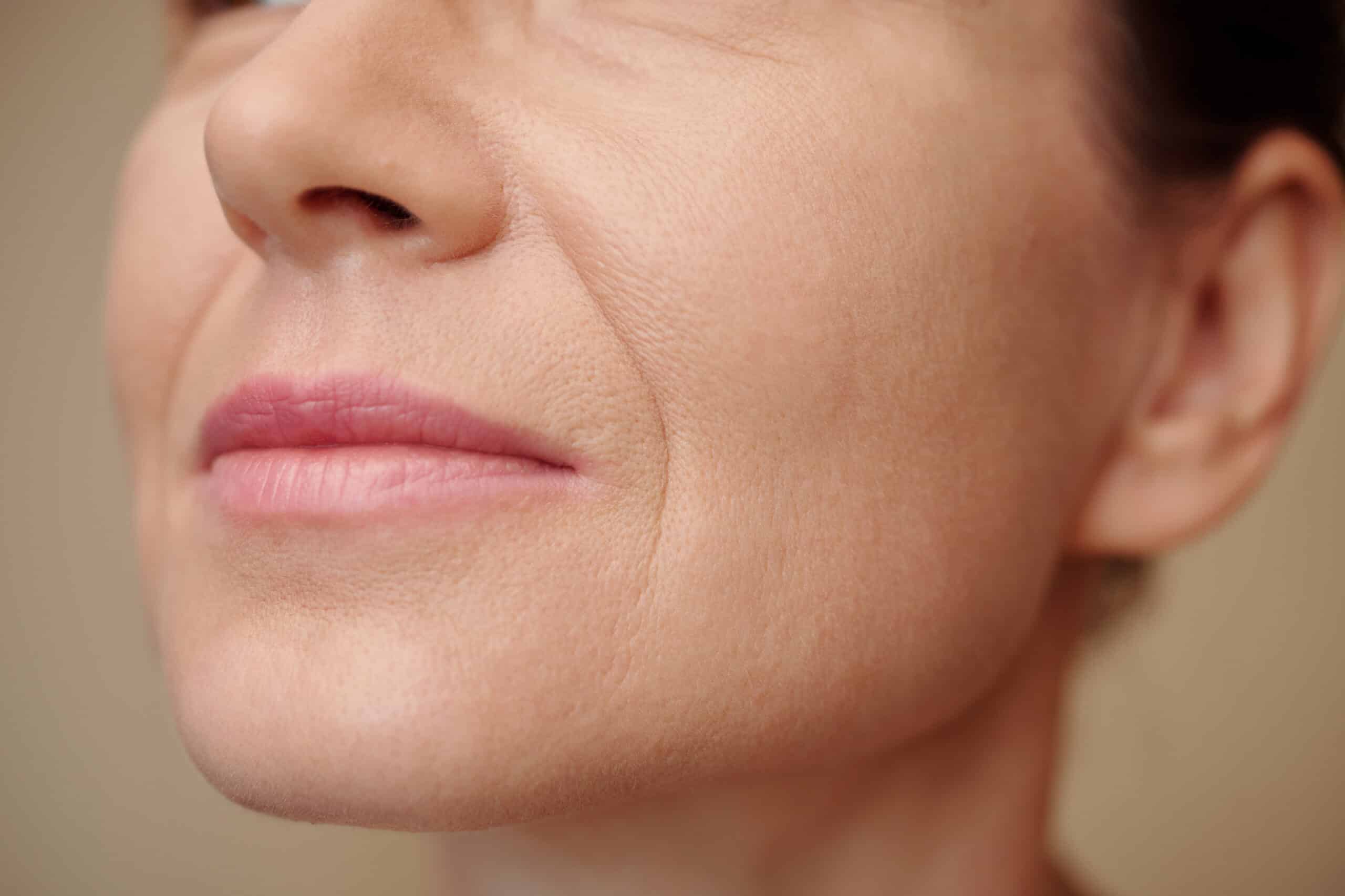 Dermal Face Fillers Singapore