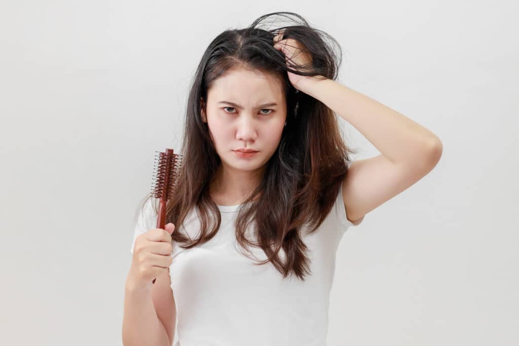 Telogen Effluvium Hair Loss