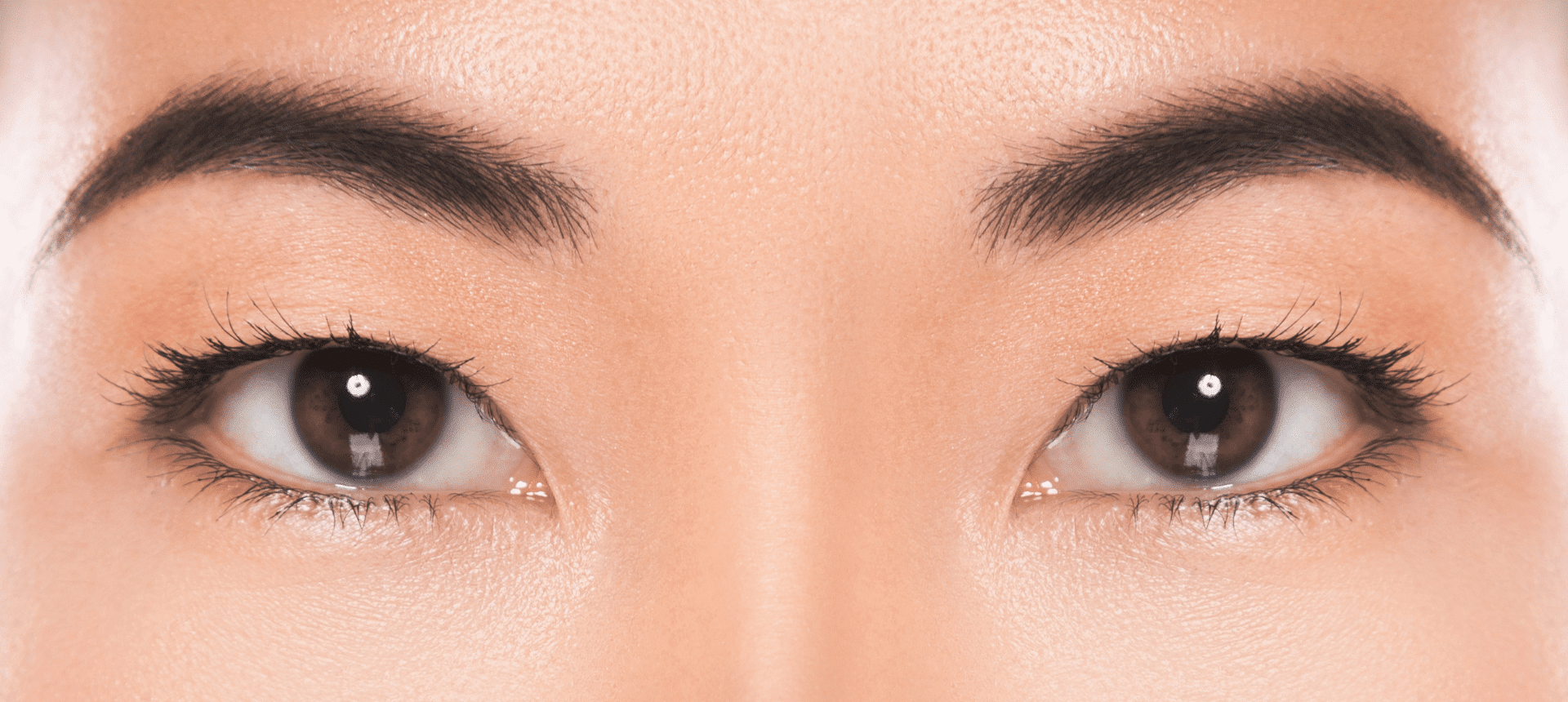 HIFU Treatment - Fotona Vector Lift Singapore (Fotona 4D 5D 6D Laser)