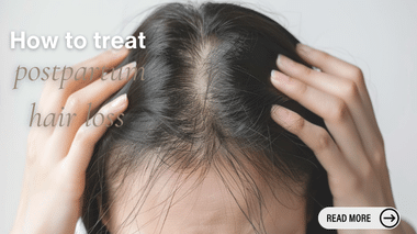 Postpartum Hair Loss Treatment